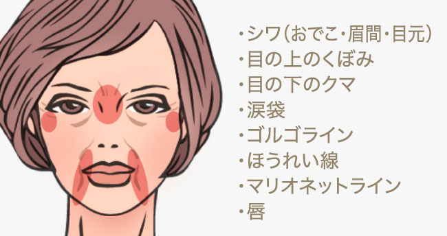 マイクロCRF